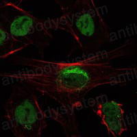 Валидация IF - AntibodySystem RHJ38701
