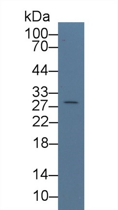 13965