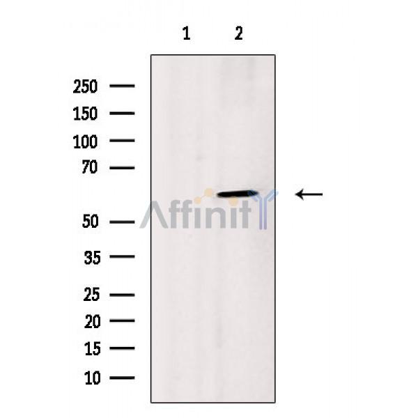 Валидация Affinity DF3838 - 14970
