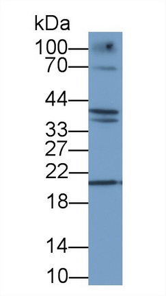 12352