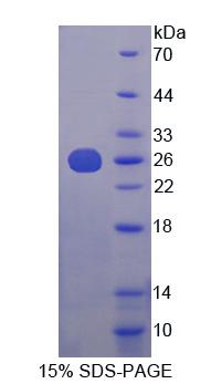 57616