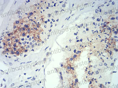 Валидация AntibodySystem RHK40801