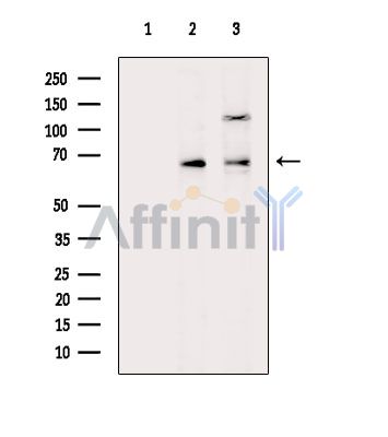 Валидация Affinity DF14885 - 11032