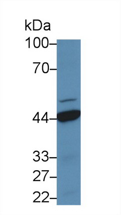13867