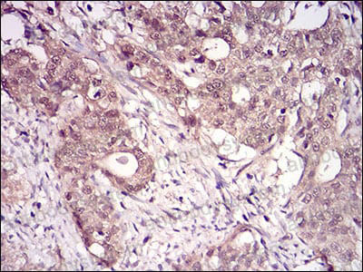 Валидация AntibodySystem RHK91801 (3743)