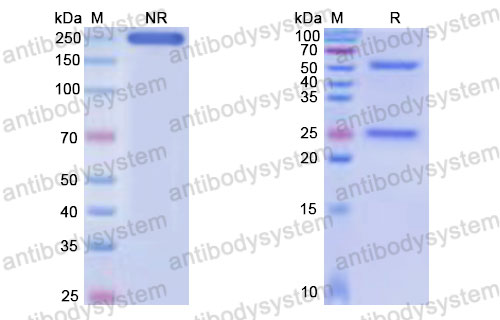 Валидация SDS-PAGE - AntibodySystem DHE58701