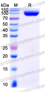 AHJ51604, SDS-PAGE