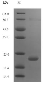 SDS-PAGE
