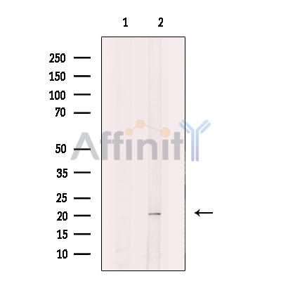 Валидация Affinity DF12436 - 6956