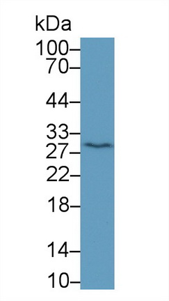 14854