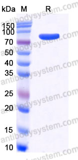 EHB13901, SDS-PAGE