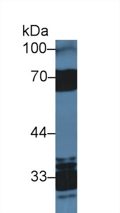 14359