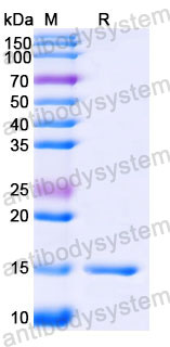 Валидация SDS-PAGE - AntibodySystem RHJ51401