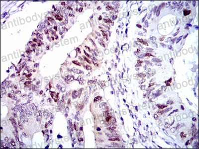 Валидация AntibodySystem RHD64705
