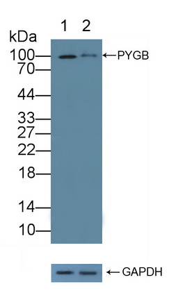 12116