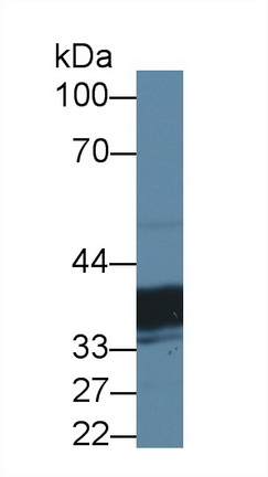 12744