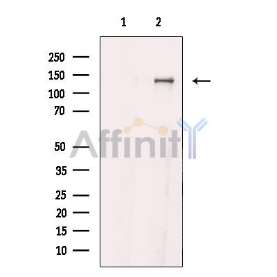 Валидация Affinity DF10333 - 5955