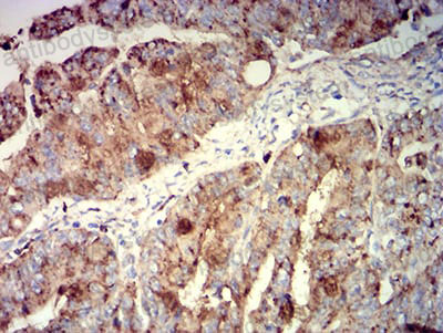 Валидация AntibodySystem RHC37602