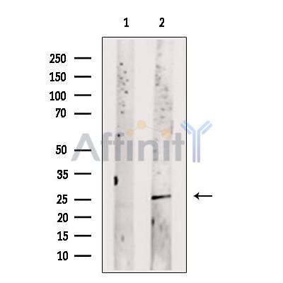 Валидация Affinity DF2964 - 13712