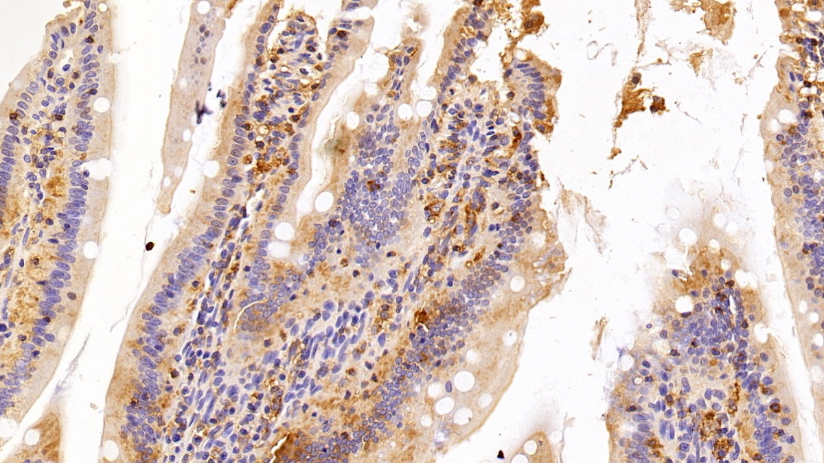26635