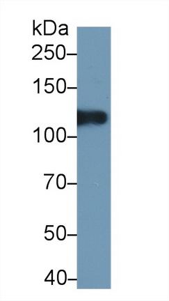 12362