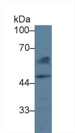 14249