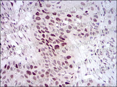Валидация AntibodySystem RHJ36801