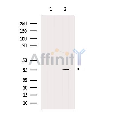 Валидация Affinity DF10020 - 5464