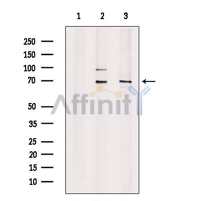 Валидация Affinity DF13281 - 8393