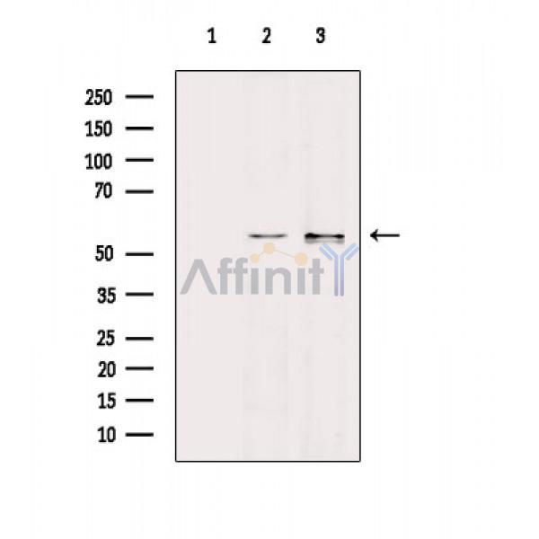 Валидация Affinity DF8563 - 20461