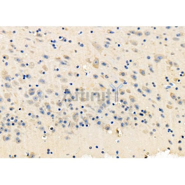 Валидация Affinity DF8580 - 20487