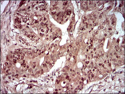 Валидация AntibodySystem RHA62802