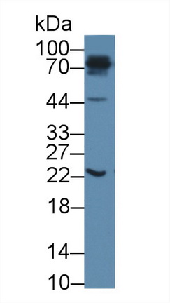 14125
