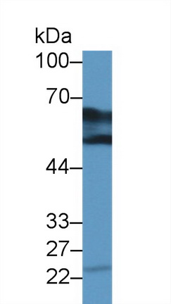 9990