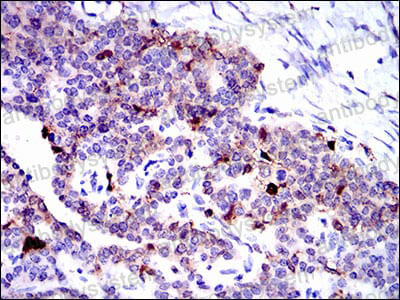 Валидация AntibodySystem RHC06203 (582)