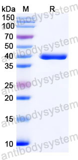 Валидация SDS-PAGE - AntibodySystem RVV14703
