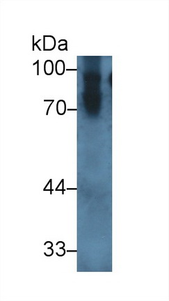 14916