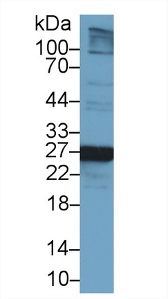13677