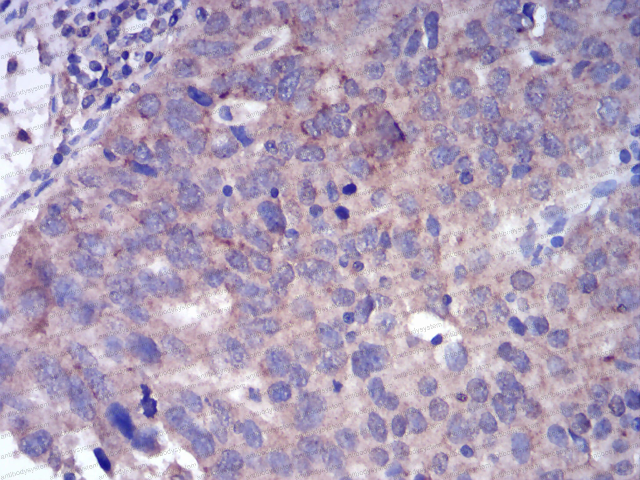 Валидация AntibodySystem RHD52903 (1627)