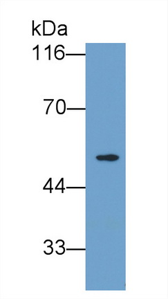 5175