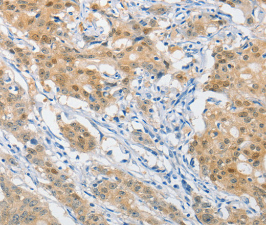 Валидация Elabscience E-AB-14642