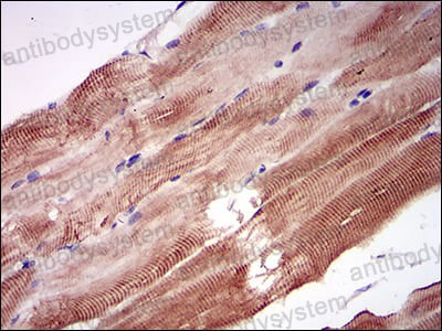 Валидация AntibodySystem RHA41902 (131)