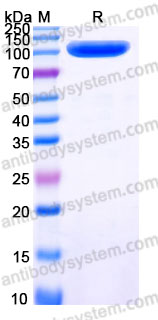 AHD48401, SDS-PAGE