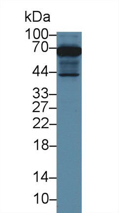 13918