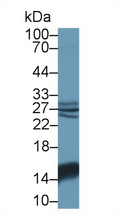 14538
