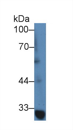 9018