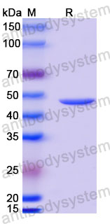 Валидация SDS-PAGE - AntibodySystem RVV13408