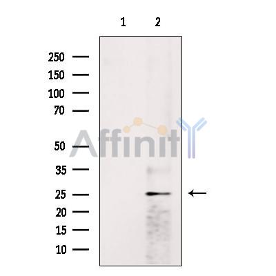 Валидация Affinity DF13369 - 8601