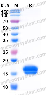 EHK06401, SDS-PAGE