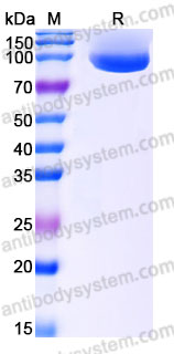 AHA30101, SDS-PAGE
